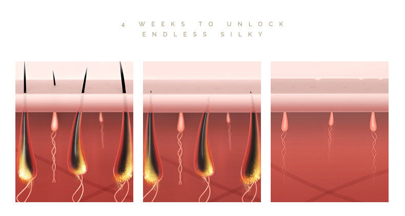 Laser Hair Removal Laser